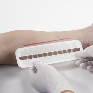 Dispositivo de Cierre de Heridas con Cinta Elástica de PU para Cierre de Heridas de Emergencia, Apósito Avanzado para Heridas - Product Image 5