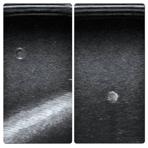 Mannequin d'entraînement à la biopsie mammaire guidée par ultrasons IG004-S2 |   Modèle avancé de ponction mammaire avec 6 lésions, couche cutanée et base incluses - Product Image 6