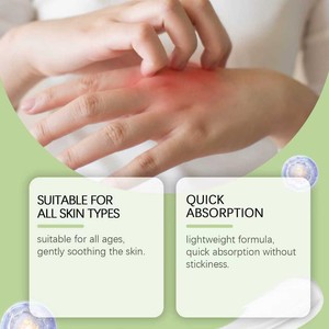 Itch Cream Crema antimicótica <span class=keywords><strong>natural</strong></span> <span class=keywords><strong>Tratamiento</strong></span> extra fuerte con aceite de árbol de té Aloe Vera Lavanda y manzanilla - Product Image 3