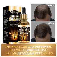 Serum Penumbuh Rambut Biotin Label Pribadi Vitamin B7 Ekstrak Tumbuhan Mengaktifkan Folikel Rambut Menyeimbangkan Minyak Kulit Kepala Perawatan Rambut