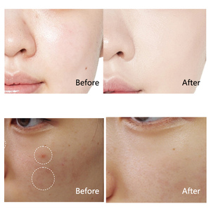 Nueva llegada Venta al por mayor Cuidado DE LA PIEL Blanqueamiento orgánico Antienvejecimiento Revitalizador facial Hidratante Etiqueta privada Crema facial de retinol - Product Image 2