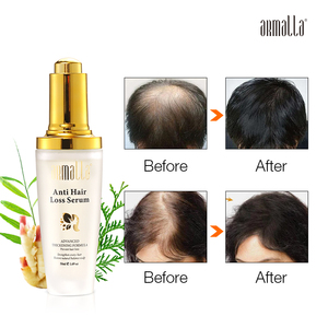 Armalla OEM Traitement Anti-Chute Capillaire Soin du Cuir Chevelu Huile Sérum Bio au Gingembre Sans Rinçage pour la Croissance des Cheveux et Contre la Perte de Cheveux - Product Image 6