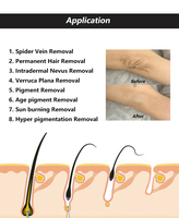 Épilation permanente par électrolyse, aiguilles d'électrolyse 0,01 mm pour cheveux blancs, élimination des varices et des vaisseaux sanguins