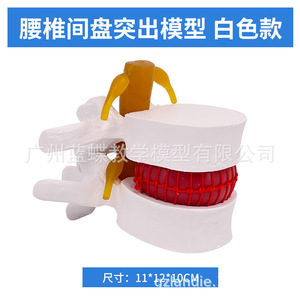 Modèle de démonstration de compression des disques intervertébraux lombaires humains, modèle d'agrandissement de la colonne vertébrale lombaire, colonne vertébrale pathologique - Product Image 5