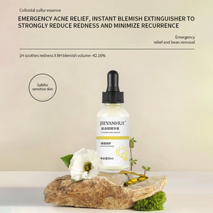 Suero de <span class=keywords><strong>Azufre</strong></span> Coloidal de Marca Privada para <span class=keywords><strong>el</strong></span> Acné, Corrector de Manchas Oscuras, Minimizador de Poros, Control de Grasa, Suero Facial Iluminador OEM - Product Image 1