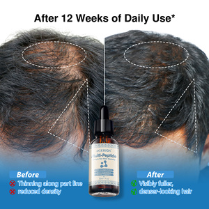 Sérum de traitement de repousse des cheveux au peptide de cuivre GHK-Cu pour la perte de cheveux, multi-peptides avec Biotinoyl Tripeptide-1 pour des cheveux plus épais - Product Image 6