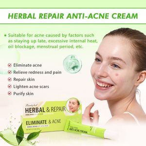 OEM Factory Organic Face Cream BHA Moisturizing Removing Blemish Skin Lightening Anti Acne Pimple Facial Cream Face Care Kit - Product Image 4