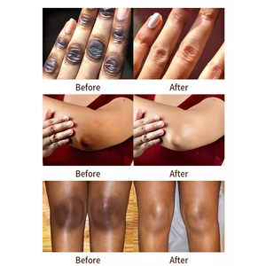 Collagène Niacinamide Anti-Rides Crème Pour Le Visage Vitamine C Acide Hyaluronique Hydratant Blanchissant pour L'élimination Des Taches Noires Soins Du Cou - Product Image 2