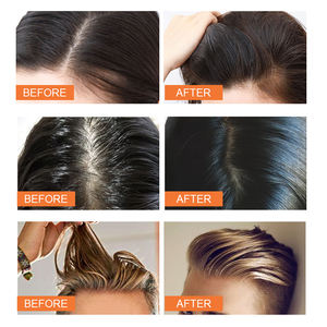 Shampooing sec en spray personnalisé pour les pellicules Shampooing sec moelleux Taille de voyage Élimine les impuretés Shampooing sec en poudre <span class=keywords><strong>sans</strong></span> eau - Product Image 3