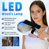 Lámpara de Wood para Dermatología, Luz Ultravioleta para Examen de Vitiligo, Psoriasis y Eccema, Dermatoscopio, Analizador de Piel