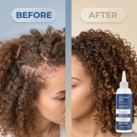 Crème capillaire hydratante sans rinçage à marque privée avec 1 % de pyrithione de zinc antichute et huile de coco exfoliante pour le soin du cuir chevelu