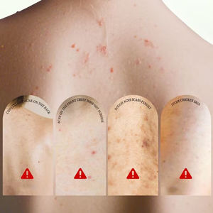 <span class=keywords><strong>ส</strong></span><span class=keywords><strong>เปร</strong></span><span class=keywords><strong>ย์</strong></span>กัน<span class=keywords><strong>ส</strong></span>ิว60มล. ฉลากครีม<span class=keywords><strong>กันแดด</strong></span>กันแ<span class=keywords><strong>ส</strong></span>ง UV แบบธรรมชาติกันแสง UV - Product Image 6