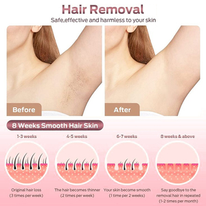 Chuyên nghiệp TGA phê duyệt Máy tẩy lông bằng laser <span class=keywords><strong>Diode</strong></span> Laser 808nm 755nm 1064nm - Product Image 4