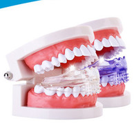 Ensemble de 3 étapes d'alignement dentaire en silicone pour enfants – Appareil orthodontique et redresseur de dents