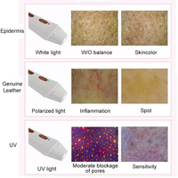 Professional Skin Analyzer Machine with Multi Spectral Detection HT DS02A for Facial Pore Sebum and Wrinkle Analysis Report