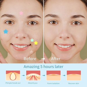 Patchs Hydrocolloïdes Colorés pour l'Acné – Soins de la Peau, Autocollants de Couverture pour Boutons et Imperfections - Product Image 3