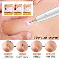 Venta al por mayor de fábrica: Lápiz láser de plasma para eliminar manchas oscuras, verrugas y acrocordones.