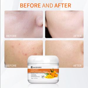 Crema de Cúrcuma y Niacinamida Blanqueadora, Repara la Piel, Hidrata, Ilumina la Piel, Crema Vegana Orgánica para el Cuidado de la Piel, Cosmética Halal - Product Image 5