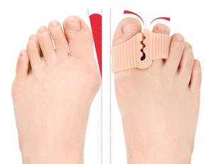 Nuevo diseño de gel de silicona SEBS cuidado de los pies elástico 2 agujeros separador de dedos Hallux valgus Dispositivo de corrección de <span class=keywords><strong>juanetes</strong></span> para <span class=keywords><strong>chanclas</strong></span> - Product Image 4