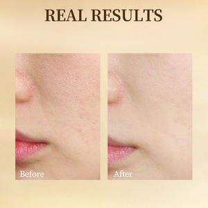 100g Aloe Vera Espuma de lavado de cara <span class=keywords><strong>simple</strong></span> BHA <span class=keywords><strong>Limpiador</strong></span> <span class=keywords><strong>facial</strong></span> <span class=keywords><strong>Gel</strong></span> exfoliante purificante orgánico Equilibrio de pH - Product Image 4