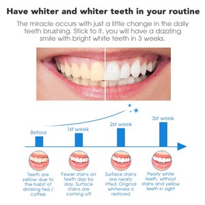 Sabor a menta 6% HP Beautiful Smile Elastic doble gel tiras de blanqueamiento de dientes - Product Image 2