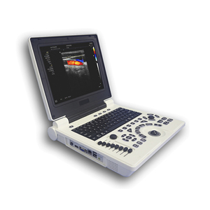 Échographe <span class=keywords><strong>3D</strong></span> portable pour la <span class=keywords><strong>grossesse</strong></span>, échographe vétérinaire - Product Image 4