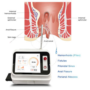 Sistema de Eliminación de Hemorroides con Lifting Endolítico por Diodo, Doble Longitud de Onda 980nm 1470nm para Hemorroides, Fístulas y Seno <span class=keywords><strong>Pilonidal</strong></span> - Product Image 4