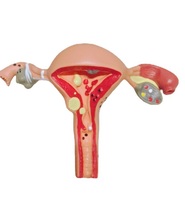 La escuela de medicina enseña el modelo humano de cambios patológicos del útero reproductivo femenino y el modelo de ovario