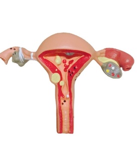 โรงเรียนแพทย์สอนแบบจําลองมนุษย์ของการเปลี่ยนแปลงทางพยาธิวิทยาของมดลูกและรังไข่ในการเจริญพันธุ์ของผู้หญิง - Product Image 2