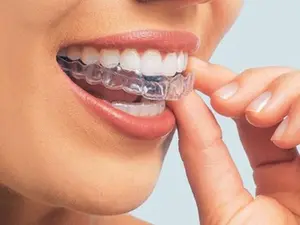 ملحقات تبييض أسنان أخرى واقي ليلي إيفا للأسنان لتشبث قطعة فم سهلة الاستخدام مع علبة حاوية