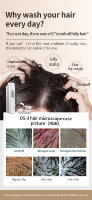 Trichoscope AI 10-200X Analyseur de Cheveux et du Cuir Chevelu 16MP Trois Spectres pour Greffe de Cheveux