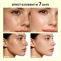 Patchs éclaircissants pour le visage de haute qualité, uniformisant le teint, anti-âge, au glutathion et NAG, pour les taches brunes