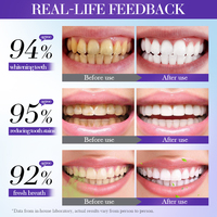 Mousse dentifrice blanchissante végétale V34 SADOER personnalisée sous marque privée, soin buccal, élimine les taches jaunes, menthe, pour usage domestique
