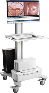 KN-2200A, instrumen kolposkopio Digital mesin colposkop vagina - Product Image 6