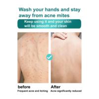 Gel Douche Éclaircissant et Exfoliant à la Vitamine C et au Curcuma, Hydratant et Illuminateur, 1000ml pour Peaux Ternes