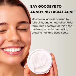 Atacado Whitening Creme Anti-Acne Creme Facial Com Ceramida Ácido Salicílico Hidrolisado Planta Colágeno Creme para o Rosto - Product Image 4