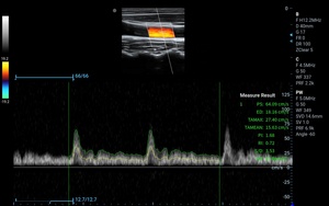Échographe Doppler Couleur Portable Zoncare M30 en Promotion – Système d'Imagerie Diagnostique 3D 4D pour Cliniques et Hôpitaux - Product Image 4