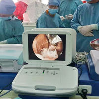 Chirurgie médicale d'urologie d'articulation de nez d'oreille caméra portative complète d'endoscope de Hd