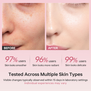 Gel Facial de Marca Privada, Belleza, Niacinamida, Blanqueador, Hidratante, Antienvejecimiento, Elimina Imperfecciones, Acné, Gel de Colágeno <span class=keywords><strong>Rosa</strong></span> Brillante - Product Image 5