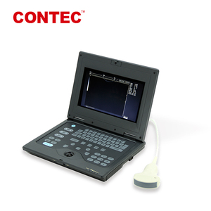 Équipement diagnostique vétérinaire courant limité de scanner animal portatif CMS600P-VET d'ultrason - Product Image 5