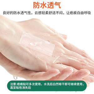 แผ่นซิลิโคนปิดแผลเป็น 4 ซม. x 2 ม. ระบายอากาศได้ สำหรับแผลเป็นเก่าและใหม่ แผลผ่าคลอด ดูแลแผลเป็น - Product Image 5