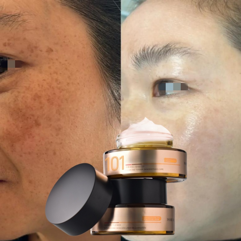 Crème anti-pigmentation