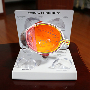 Modelo <span class=keywords><strong>de</strong></span> ojos para mostrar la ciencia médica, patología humana, para educación - Product Image 6