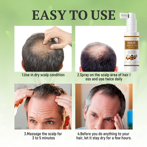 Produits de croissance des cheveux, spray de croissance des cheveux, traitements de repousse des cheveux pour la vente au détail - Product Image 5