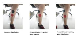 Nmmes ירידה בבית חולים ציוד בריאות הליכה סיוע פטנט אלקטרודות טיפול רפואי אורתוזיס נגד רגל - Product Image 5