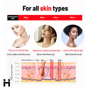 เครื่องกำจัดขนเลเซอร์ไดโอดกำจัดขน4ความยาวคลื่นเครื่องกำจัดขนเลเซอร์ไดโอด808น้ำแข็งไทเทเนียม<span class=keywords><strong>755</strong></span>เลเซอร์1064 808ใหม่ล่าสุด - Product Image 6