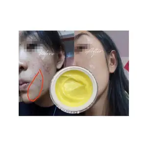 Top Selling White Body Skin Shine Beauty Glow Whitening Cream For Black Neck And Black Face Sold by Weight