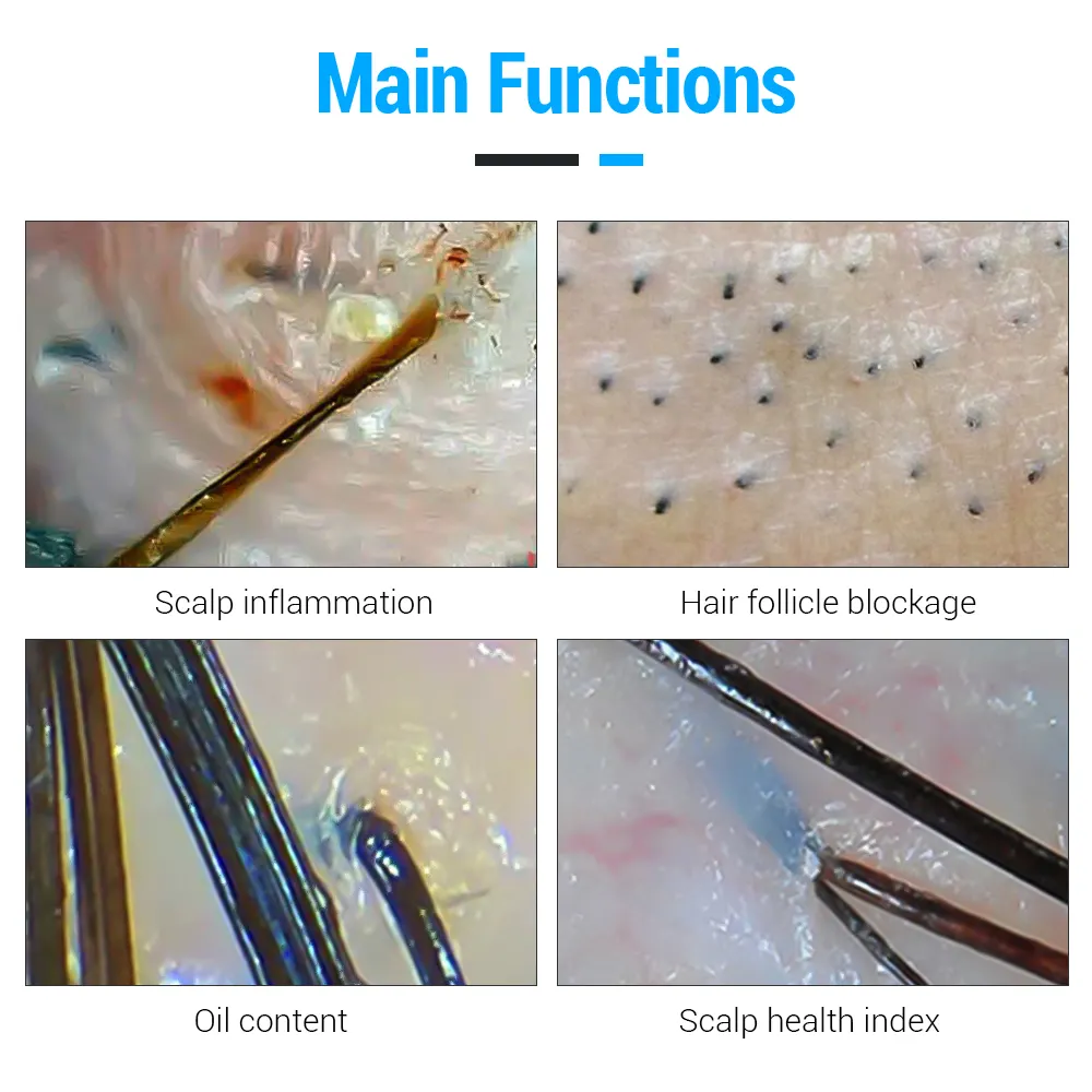 Scanner de cuir chevelu analyseur de peau et de cheveux avec 2 lentilles grand écran 50X & 200X 15 pouces