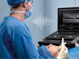 Système d'échographie vétérinaire haut de gamme Sonoscape E10, meilleur de Chine, échographie équine avec écran de 15,6 pouces, à vendre - Product Image 5