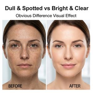 MSHASHAN Crème éclaircissante uniformisante pour <span class=keywords><strong>la</strong></span> <span class=keywords><strong>peau</strong></span> à l'extrait de mûrier personnalisée, élimination des <span class=keywords><strong>taches</strong></span>, uniformisation du teint, éclaircissement des <span class=keywords><strong>taches</strong></span>, service de traitement OEM - Product Image 5